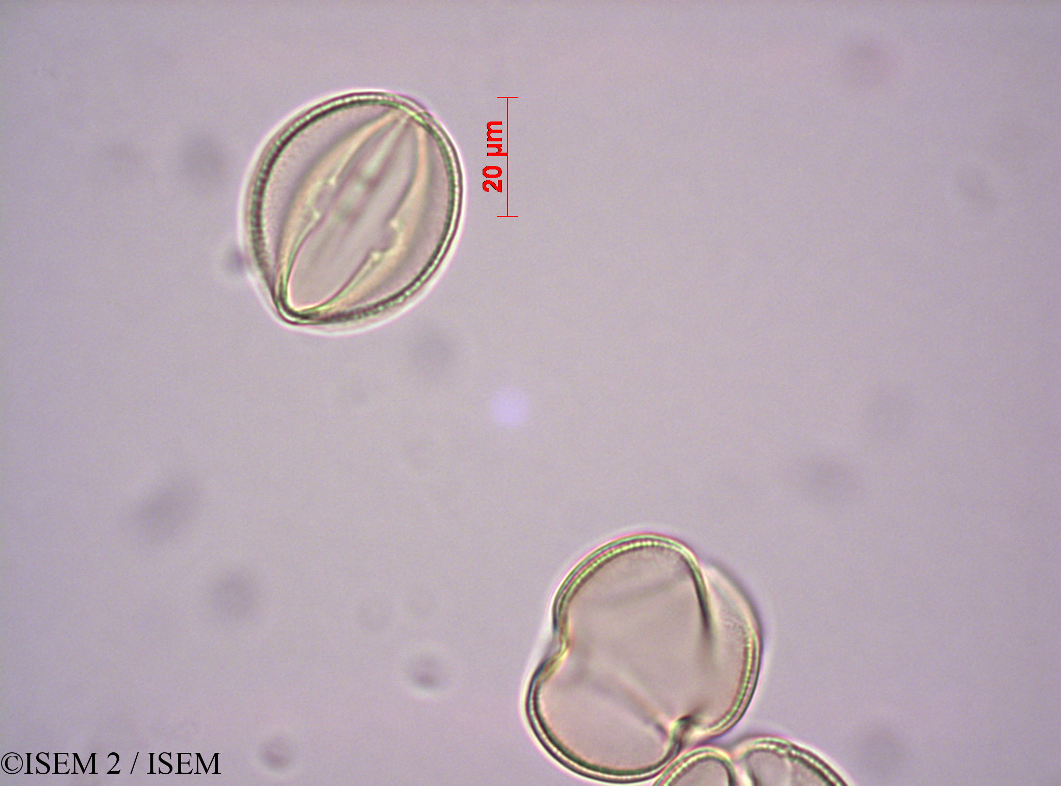 ISEM 2/Elephantorrhiza_suffruticosa_43213/Elephantorrhiza_suffruticosa_43213_0002(copy).jpg
